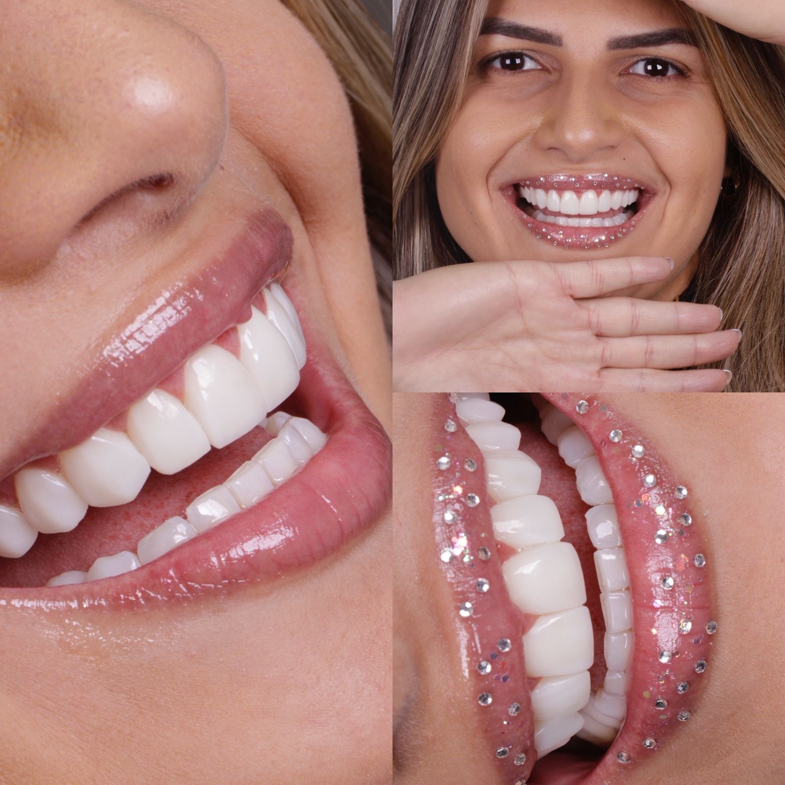 Sorrisos tratados na WO Clínica Odontológica em Contagem